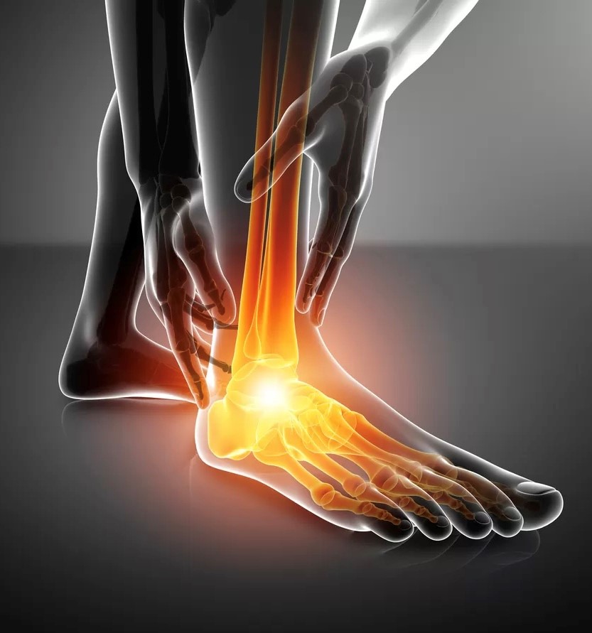 با ۱۰ روش درمانی برای ورم مچ پا بر اثر ضربه آشنا شوید!