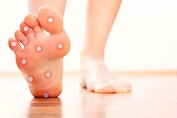 درد کف پا در افراد دیابتی